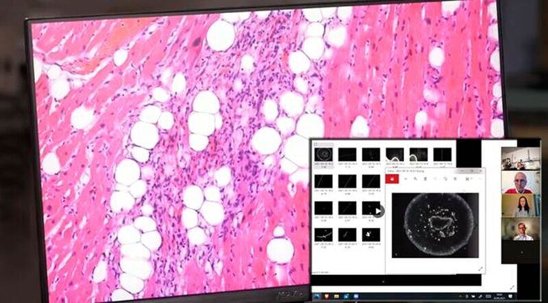 Conférence de pathologie