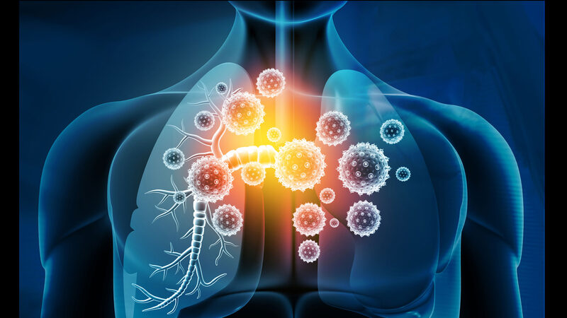 "Covid-19 : les limites de la vaccination"